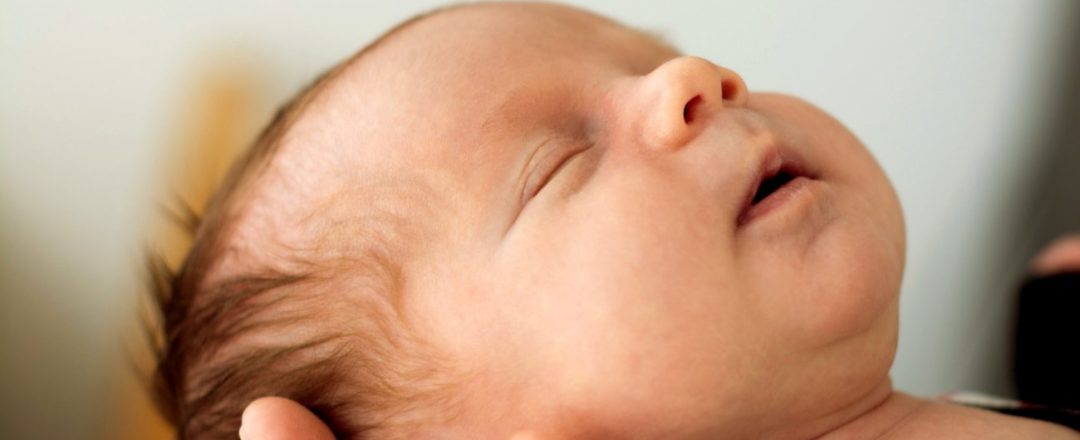 zležaná hlavička alebo kraniostenóza, hlavička novorodenca na maminej ruke
