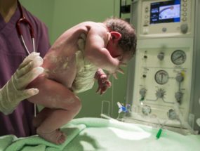 pôrodná asfyxia novorodenca